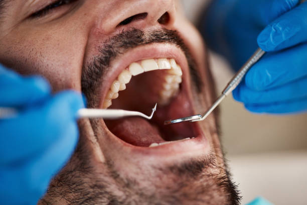 Emergency Dental Services in Fairview, NC